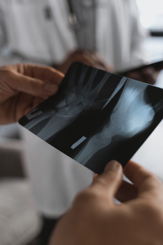 Close-up of a doctor holding an X-ray during a review, representing follow-up care with a local doctor after the family returns to Assam