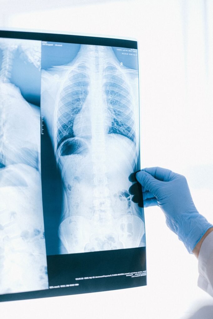Medical professional in blue gloves reviewing a chest X-ray, representing reports organised in Assam and shared with hospitals before travel