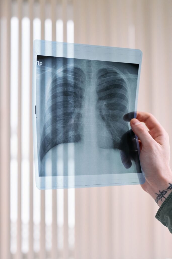 Doctor holding a chest X-ray in a clinic, representing the consultations and tests a medical concierge helps coordinate in Delhi NCR