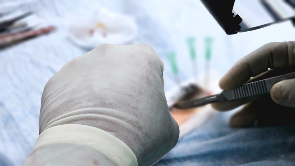 Close-up of a hair transplant procedure