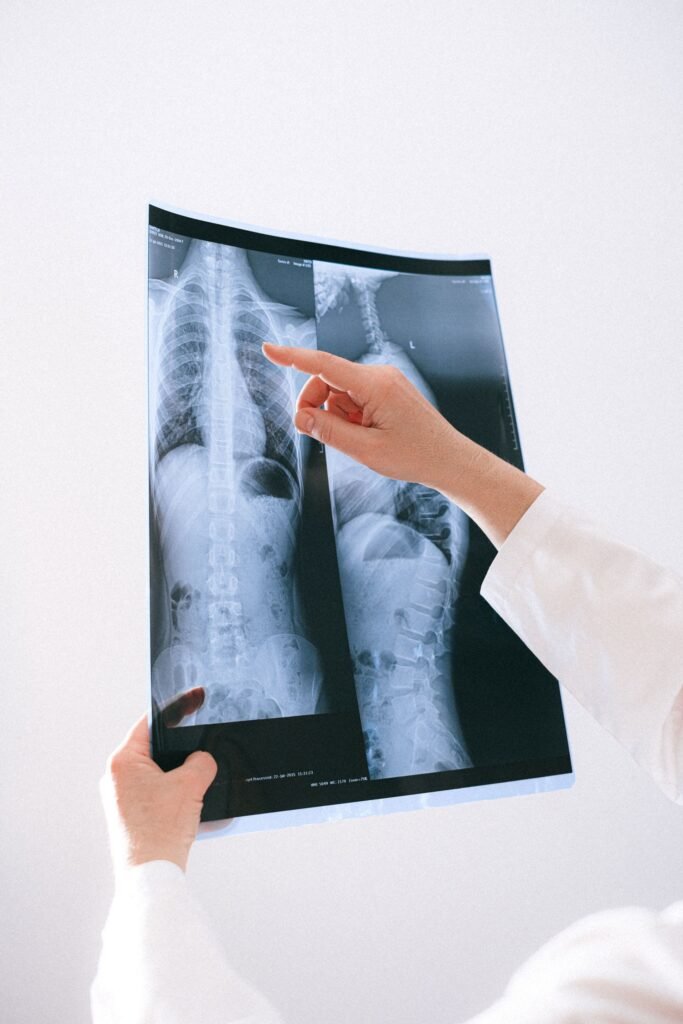 Medical professional examining a chest X-ray, representing treatment items that are billed separately from room and doctor charges