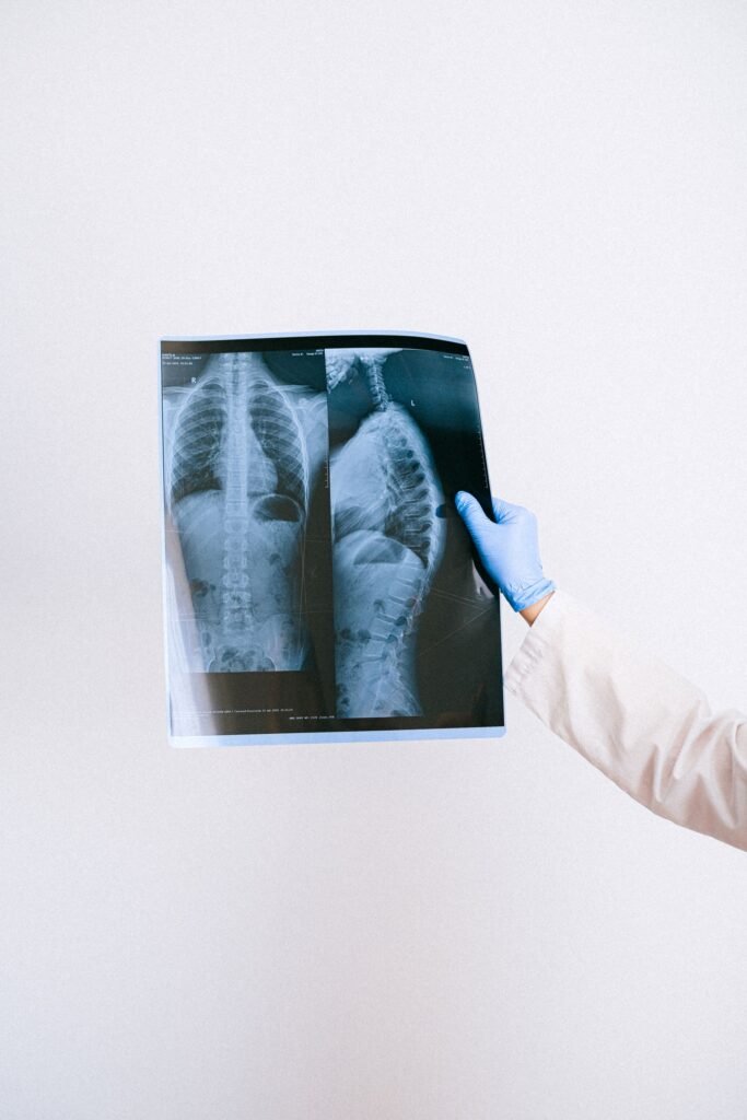 Medical professional holding an X-ray result, representing the treatment details families use when discussing hospital costs