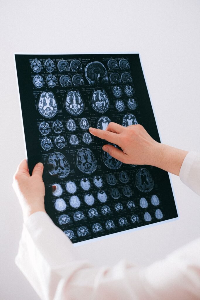 Hands holding a brain scan image, representing treatment costs checked against a health insurance policy