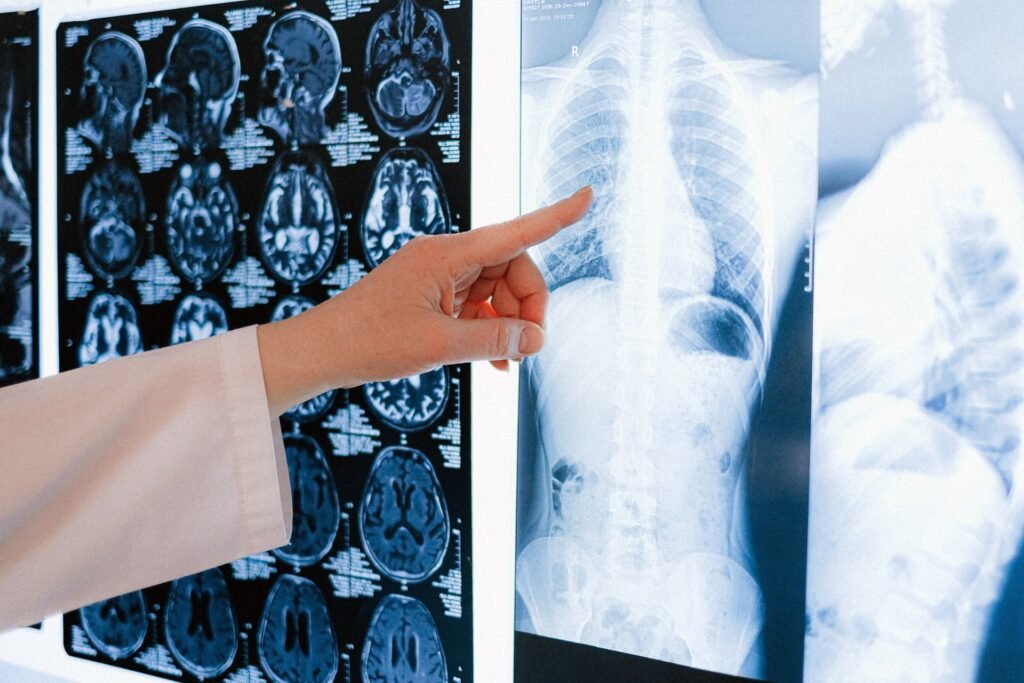 Doctor pointing at a chest X-ray among scan images, representing the specialist review families travel to Vellore for