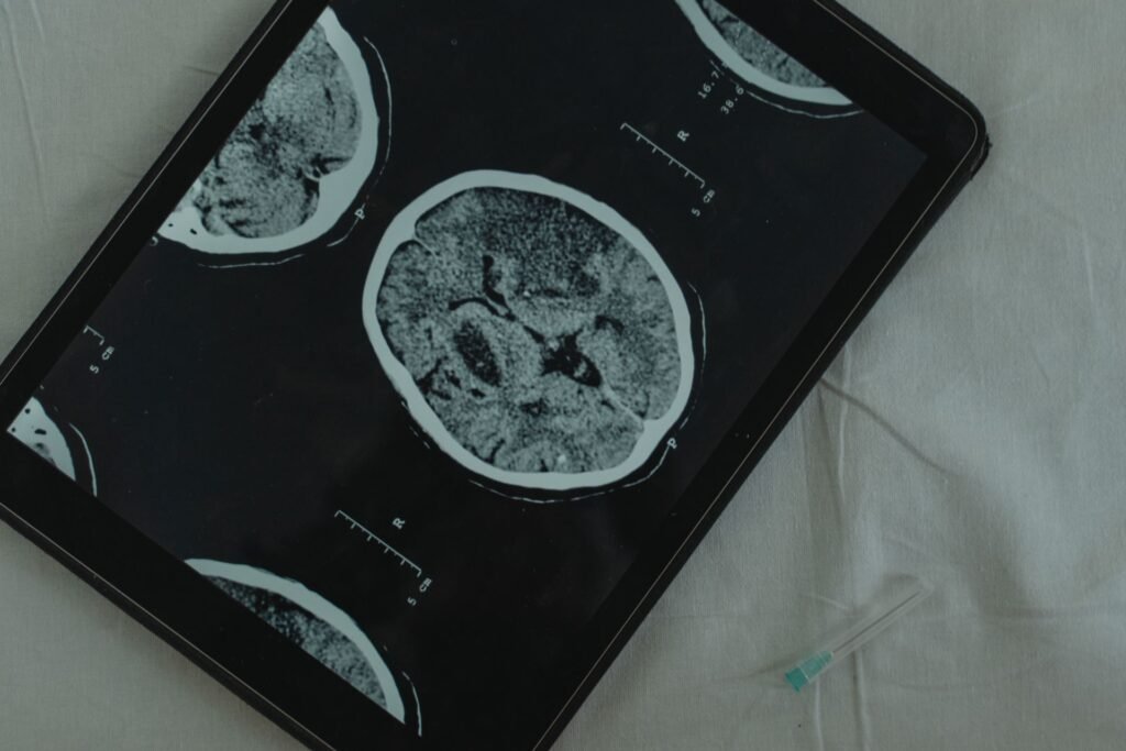 CT scan images shown on a digital tablet, representing medical reports shared with Chennai hospitals before a patient travels