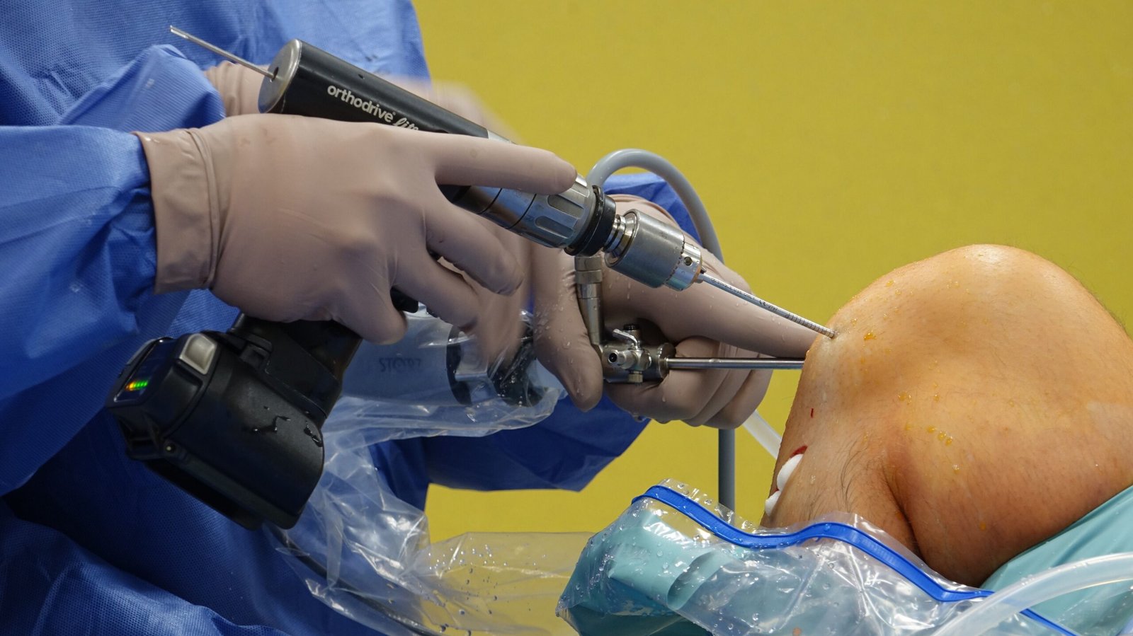 Orthopedic surgeon performing knee arthroscopy