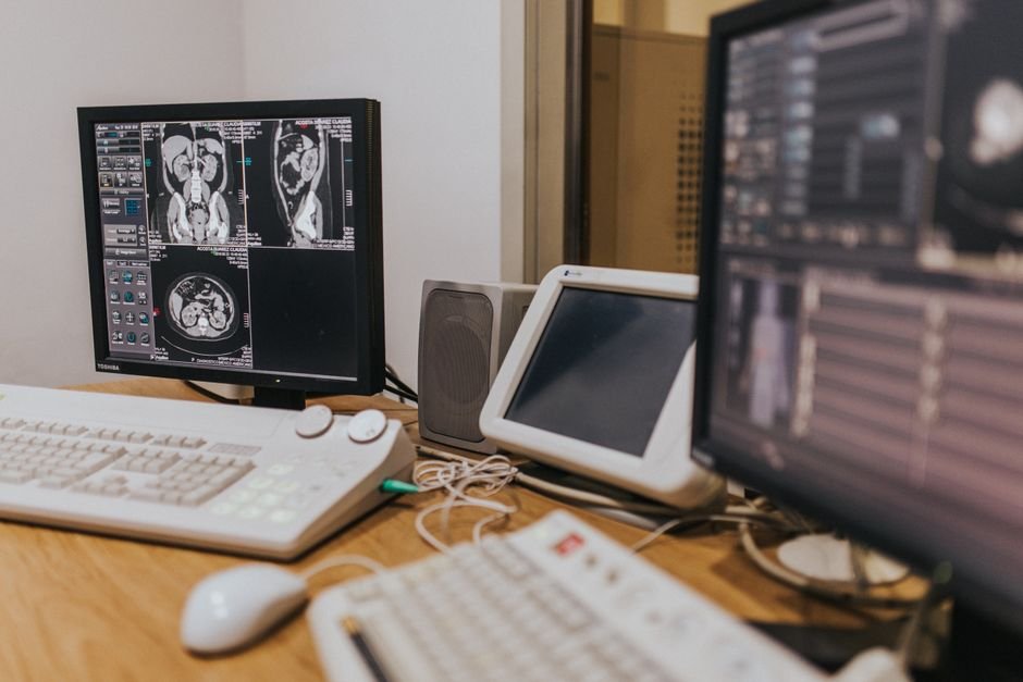 Medical imaging setup with scans displayed on multiple screens