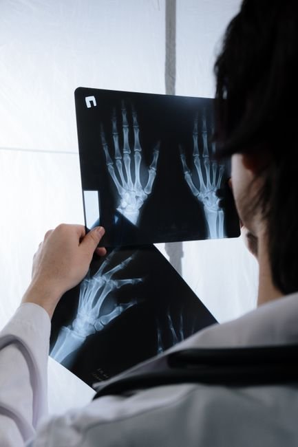 Doctor examining a hand X-ray to assess a possible injury