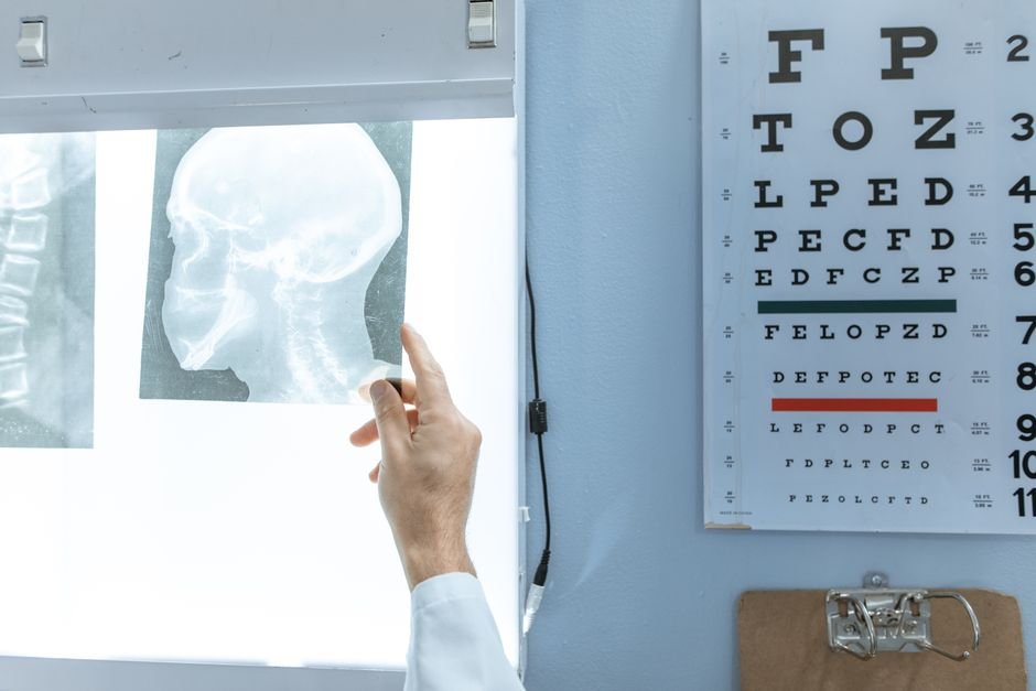 Medical professional checking an X-ray in a clinic