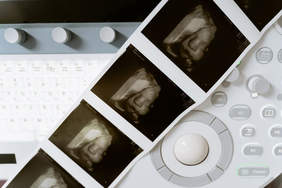 Medical scan equipment representing follow-up diagnostic coordination after treatment