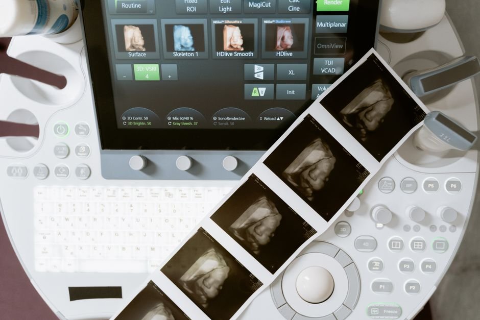 Ultrasound machine displaying 3D scans with printed sonogram images