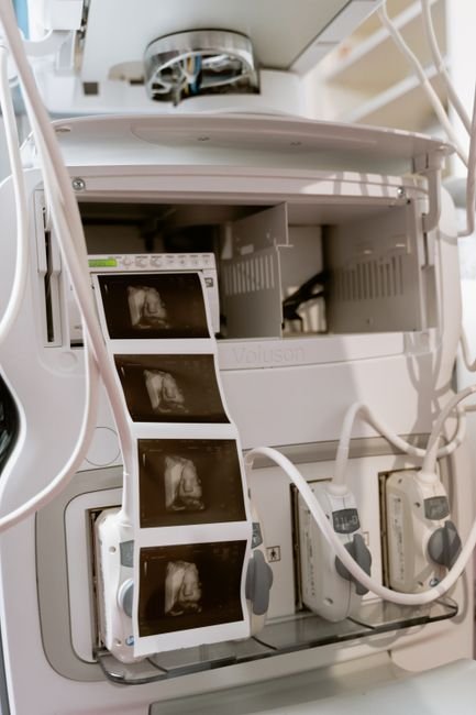 Ultrasound machine displaying scans in a diagnostic setting