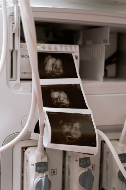 Close-up of ultrasound machine printing baby scan images