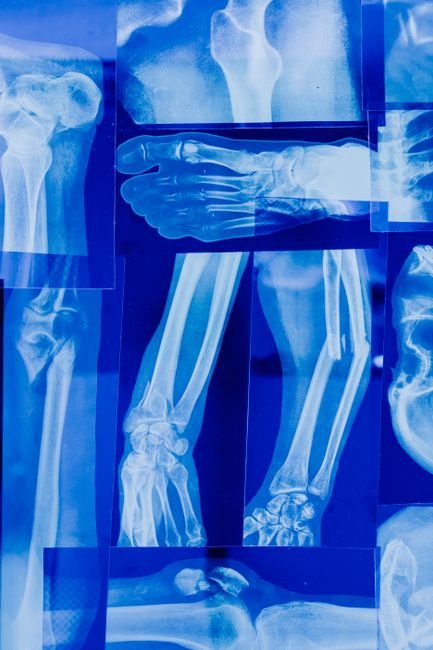 Detailed collage of human bone X-rays illustrating skeletal parts