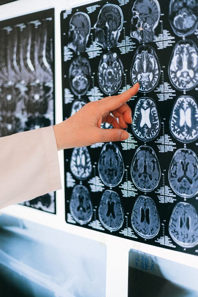 Doctor pointing to a brain scan, representing the diagnosis that decides which PM-JAY treatment package applies